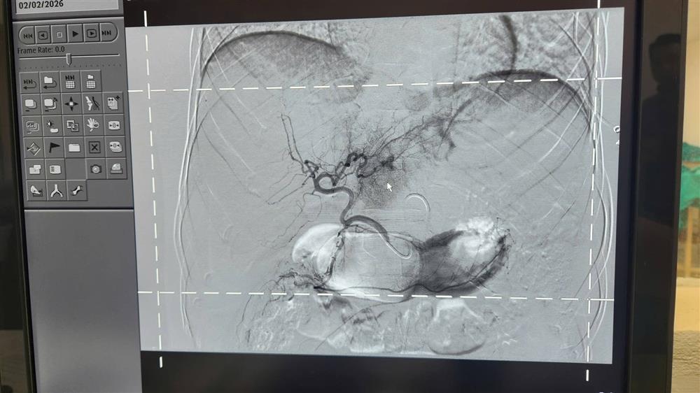 /images/companies/benhvienducgiang/images/2026/tháng 2/626406224_929079892791260_2375357760981282298_n.jpg